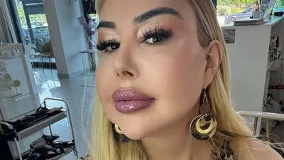 Patrícia Ribeiro descreve descoberta do prazer após cirurgia de afirmação de gênero