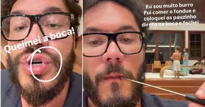 Eliezer queima os lábios ao comer fondue em casa